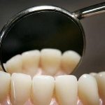 اكتشاف طبي صيني يجعل حشوات الأسنان شيئاً من الماضي